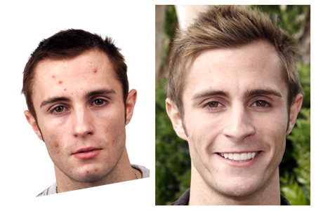 Joe Before and After